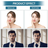 Leosportz Jaw Exerciser for Men & Women